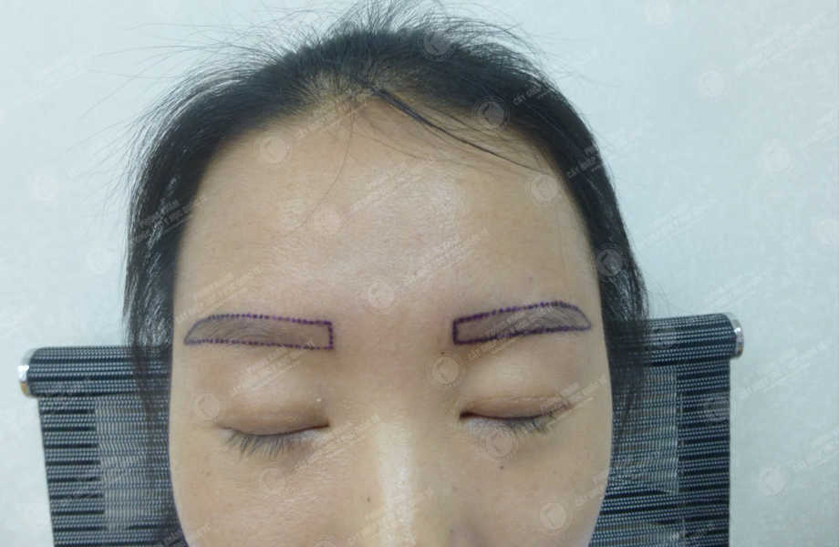Trần Phương Linh - Cấy lông mày 4