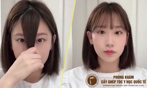 Gợi ý 5 kiểu tóc cho nữ hói che khuyết điểm cực đẹp 2023