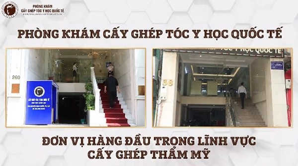 Cấy ghép tóc Y học Quốc tế số 38 Nguyễn Du – Phòng khám cấy tóc tốt nhất Hà Nội