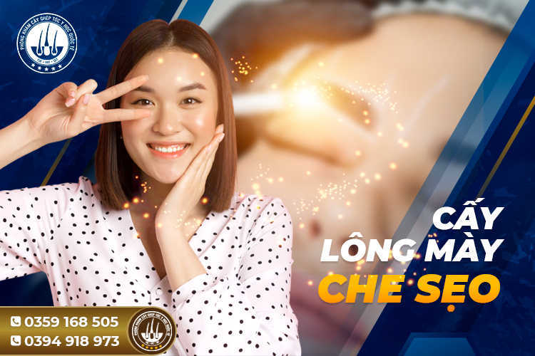 Cấy lông mày che sẹo – Phương pháp thẩm mỹ siêu HOT